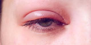 Ophthalmology