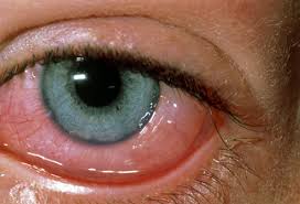 Ophthalmology